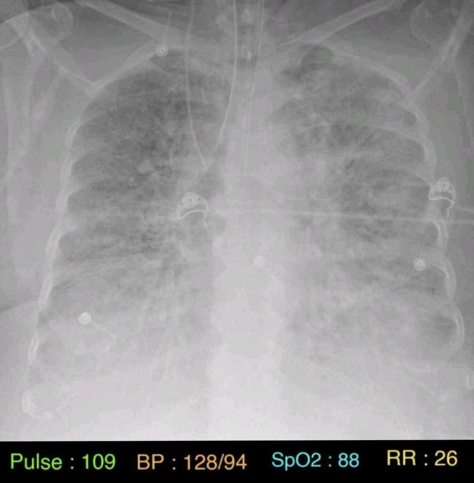 Vitale gegevens van de patiënt en röntgenfoto van de borst puzzel online van foto