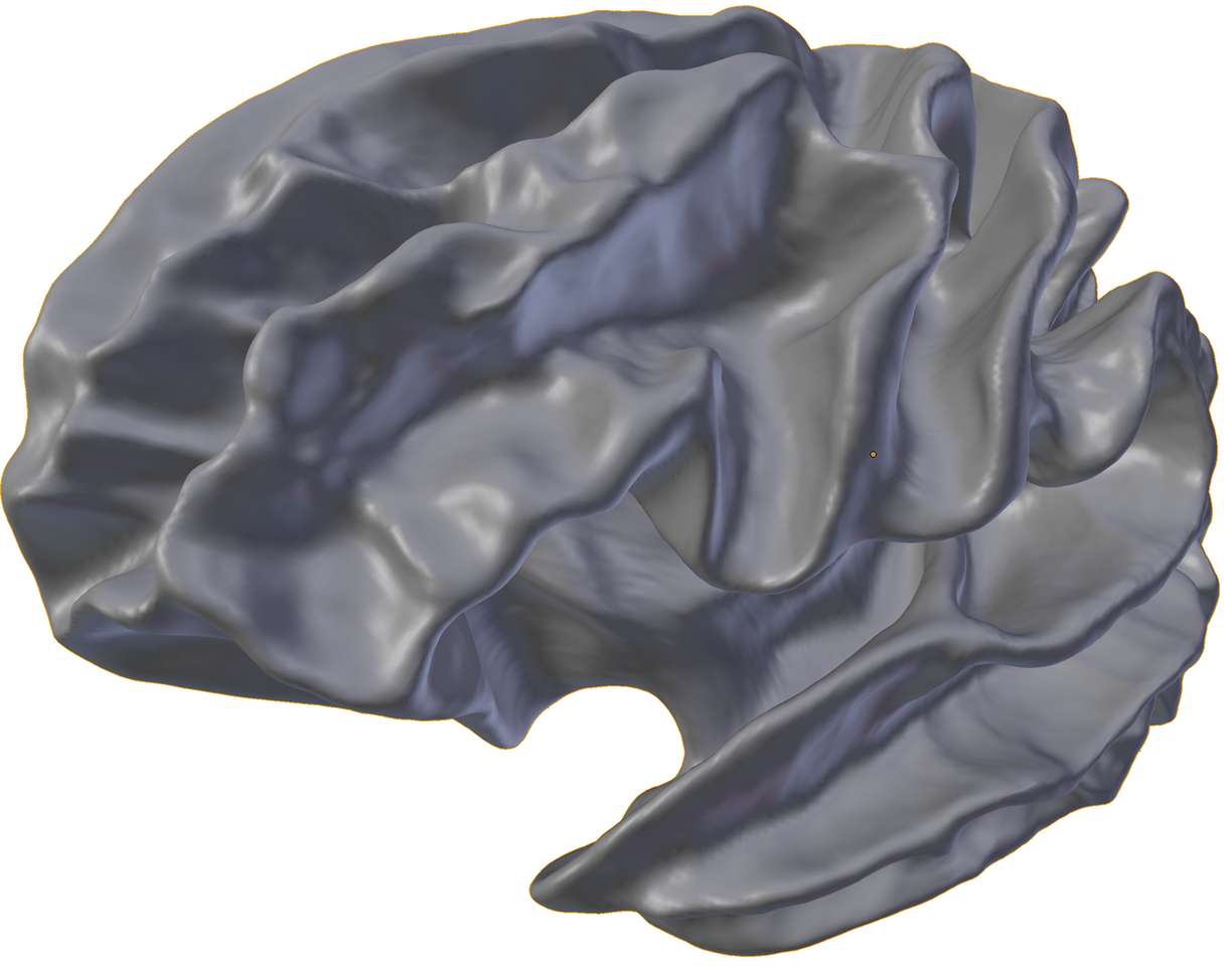 whitematter puzzle online from photo