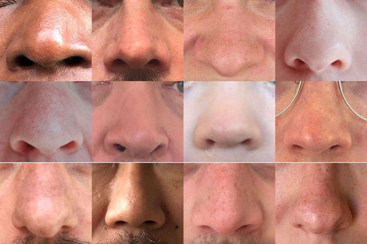 cavidad nasal puzzle online a partir de foto