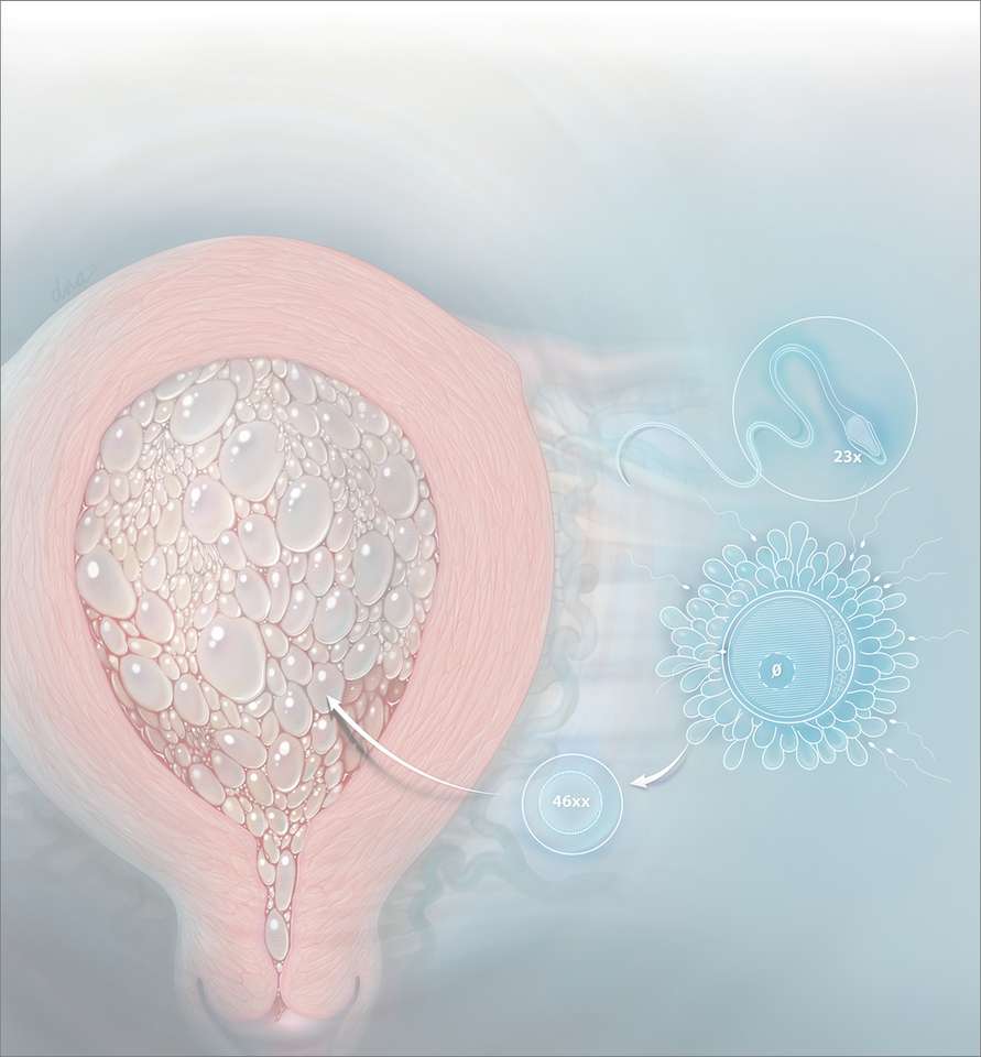 анэмбриональная беременность пазл онлайн из фото