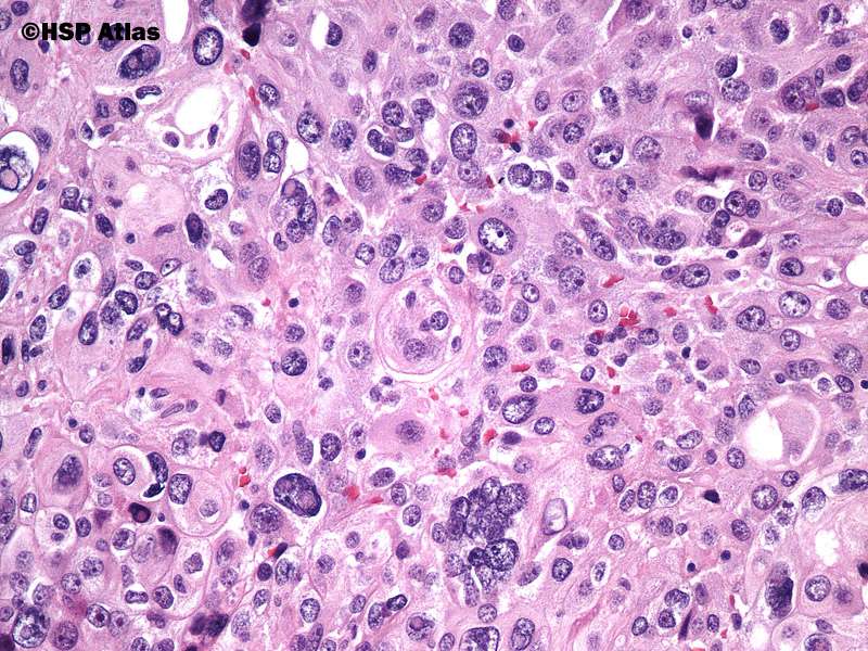 histología rompecabezas en línea