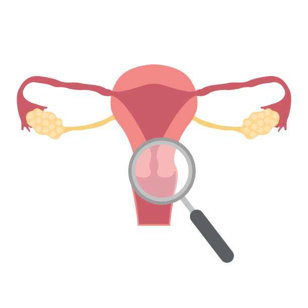 女性の人間の子宮頸部 写真からオンラインパズル