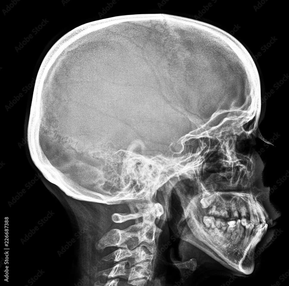 skull radiography puzzle online from photo