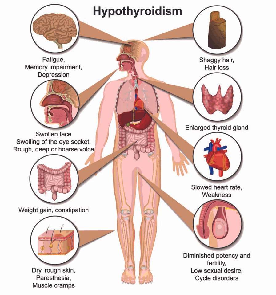 hipotiroidian puzzle online din fotografie
