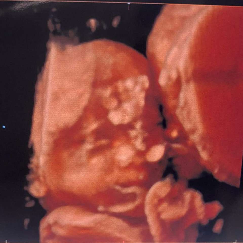 ultrassonografia de bebê puzzle online a partir de fotografia