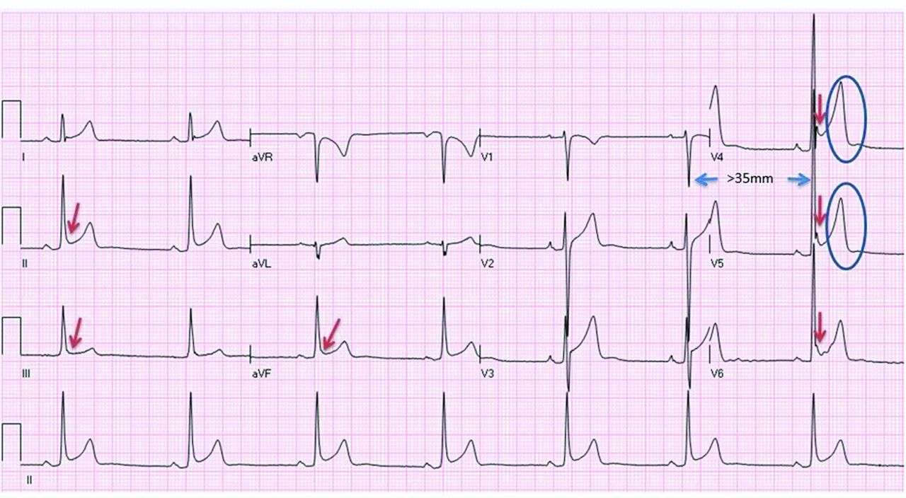 Electrocardiograph puzzle online from photo