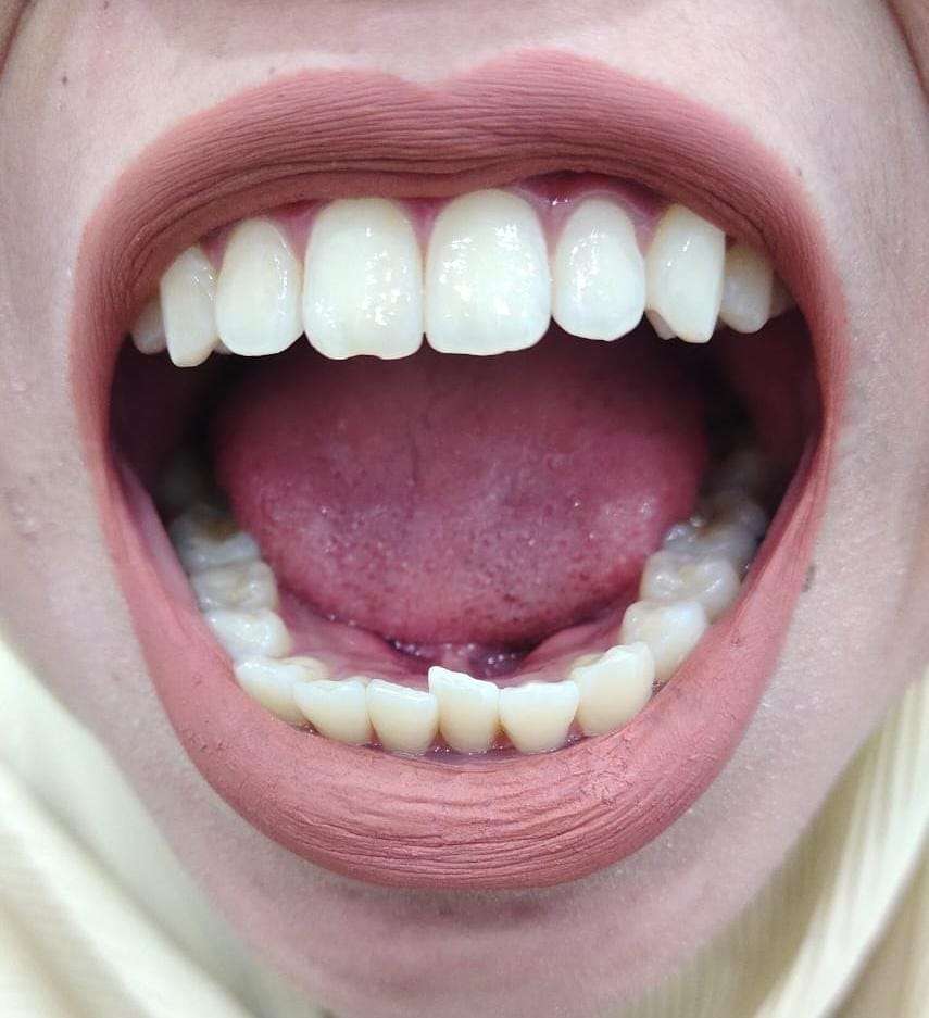 mulut manusia online puzzle
