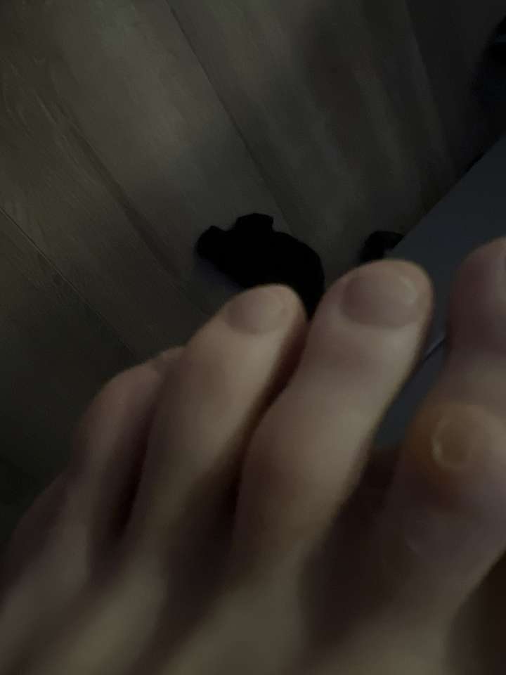 Dita dei piedi di Kevin puzzle online da foto