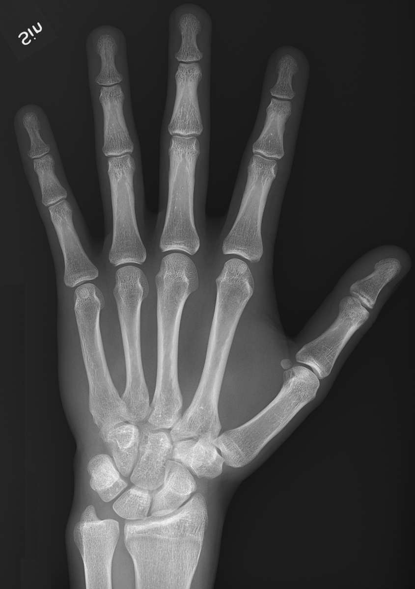 xray of hand puzzle online from photo
