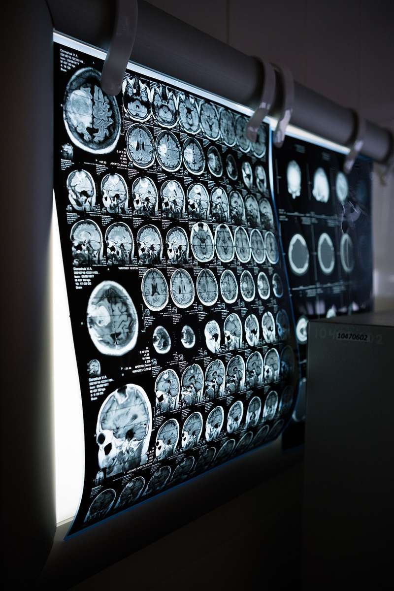 Scanners cérébraux puzzle en ligne à partir d'une photo