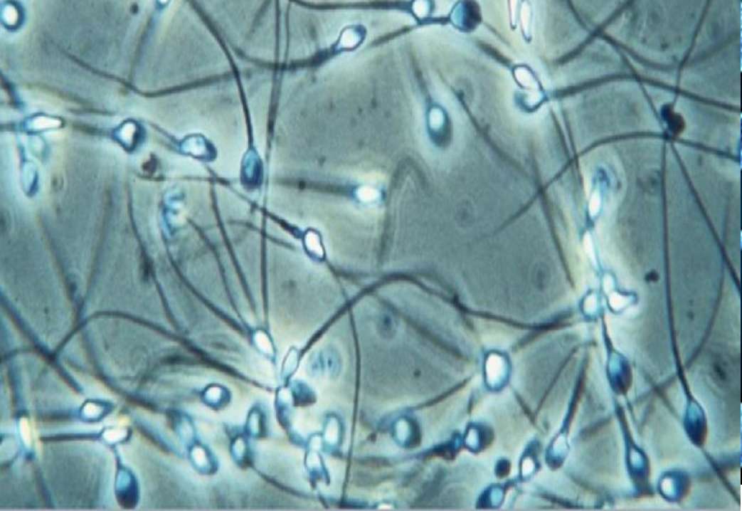 Cellules de sperme humain puzzle en ligne