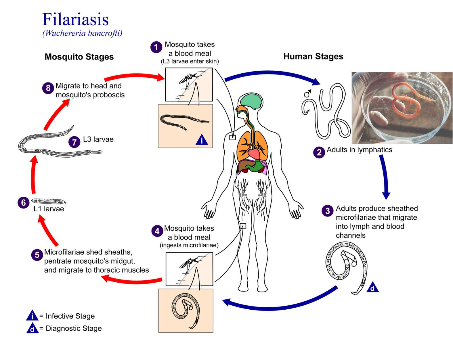 Filariasis online puzzle