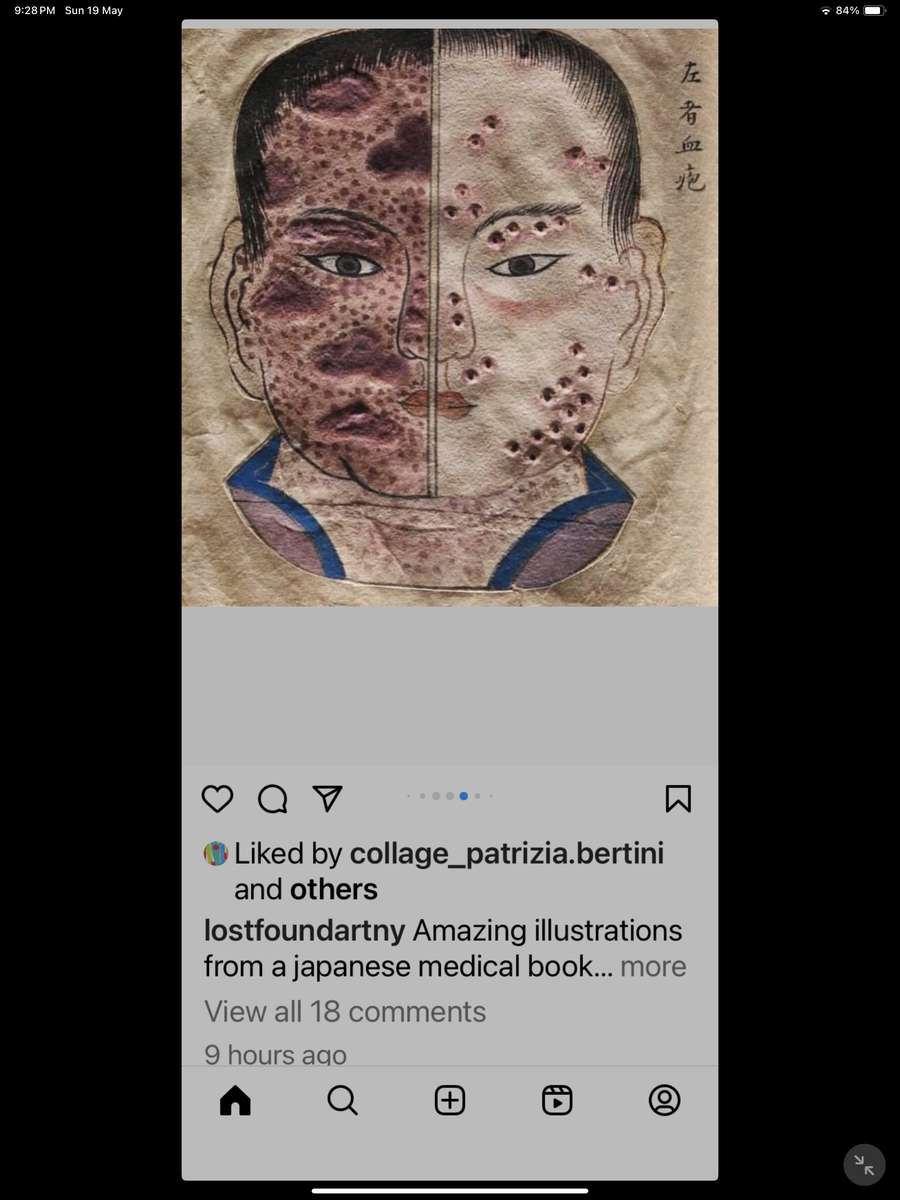 痘瘡の頭 写真からオンラインパズル