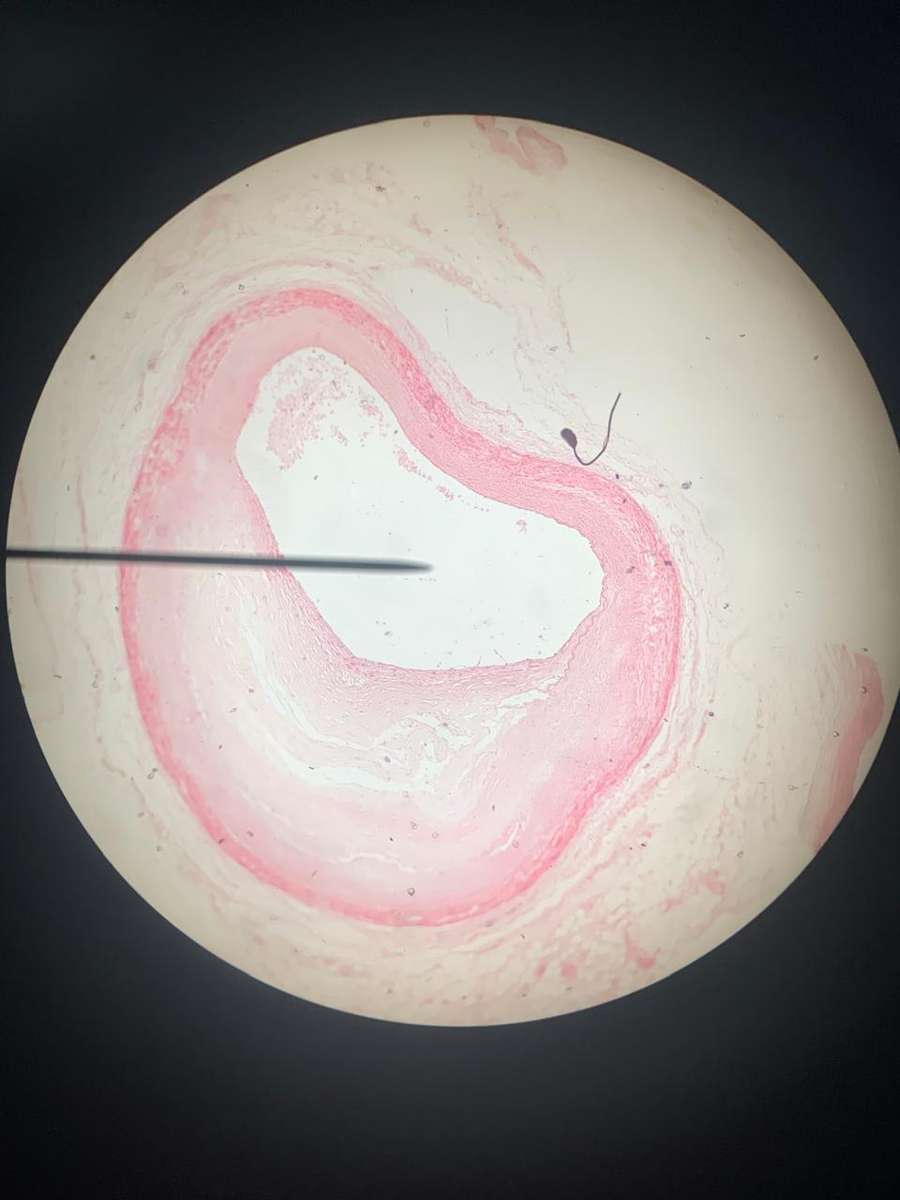 microscopy puzzle online from photo